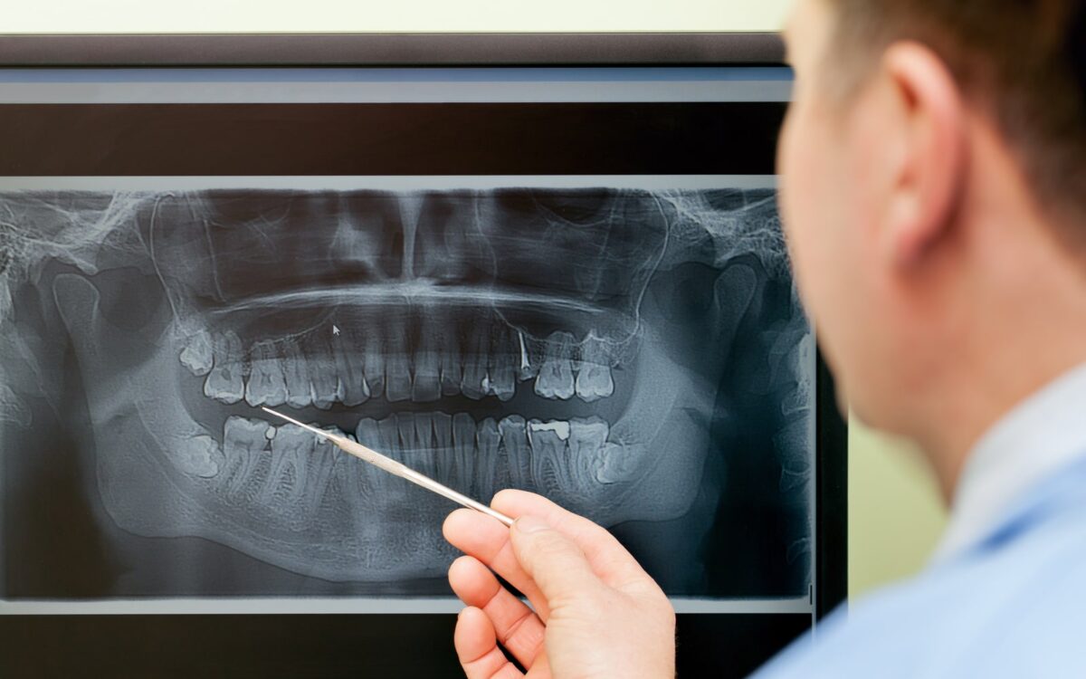 Dentist Observing Dental X-Ray Image